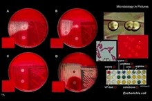 enteric bacteria